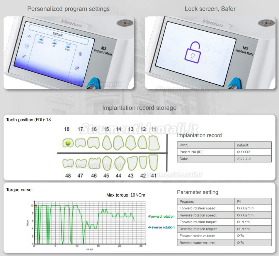 Motore implantare brushless dentale, Physiodispenser Mate M3